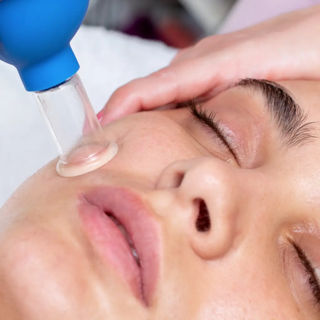 woman receiving facial cupping